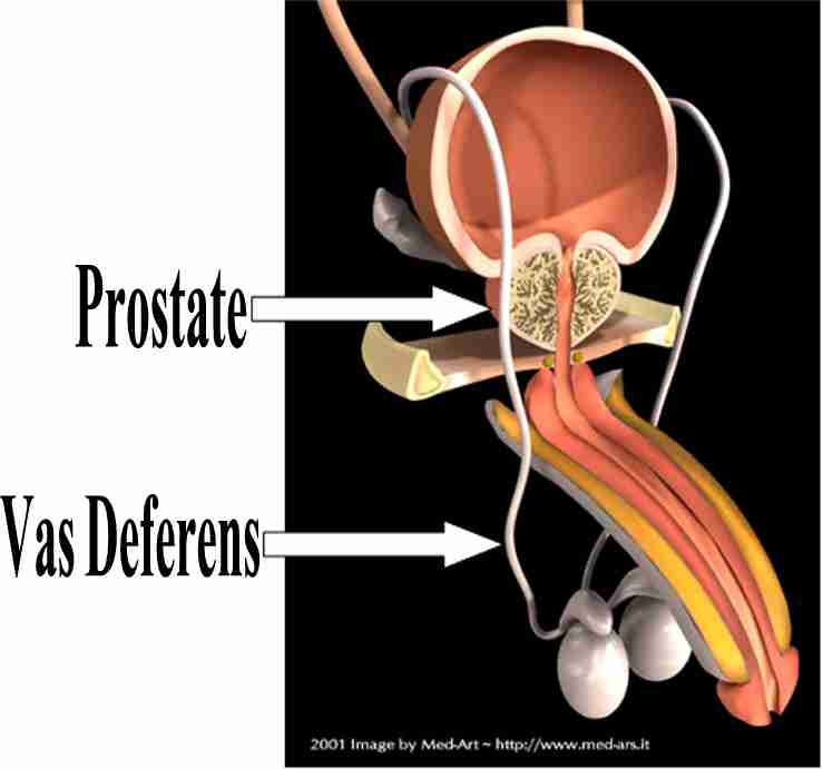 prostate1